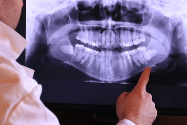 Best Broken Tooth Emergency  in Green Hill, TN