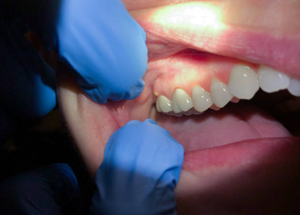 Best Urgent Tooth Repair  in Green Hill, TN